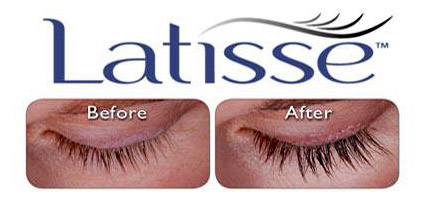 Latisse