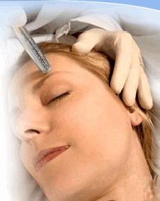 Microdermabrasion treatment